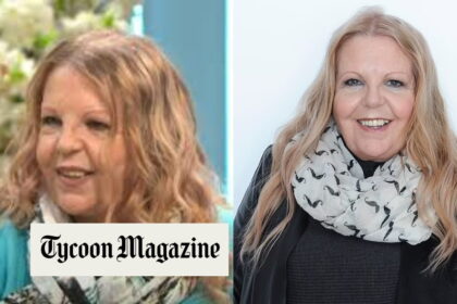 Sally Thomsett Face Illness